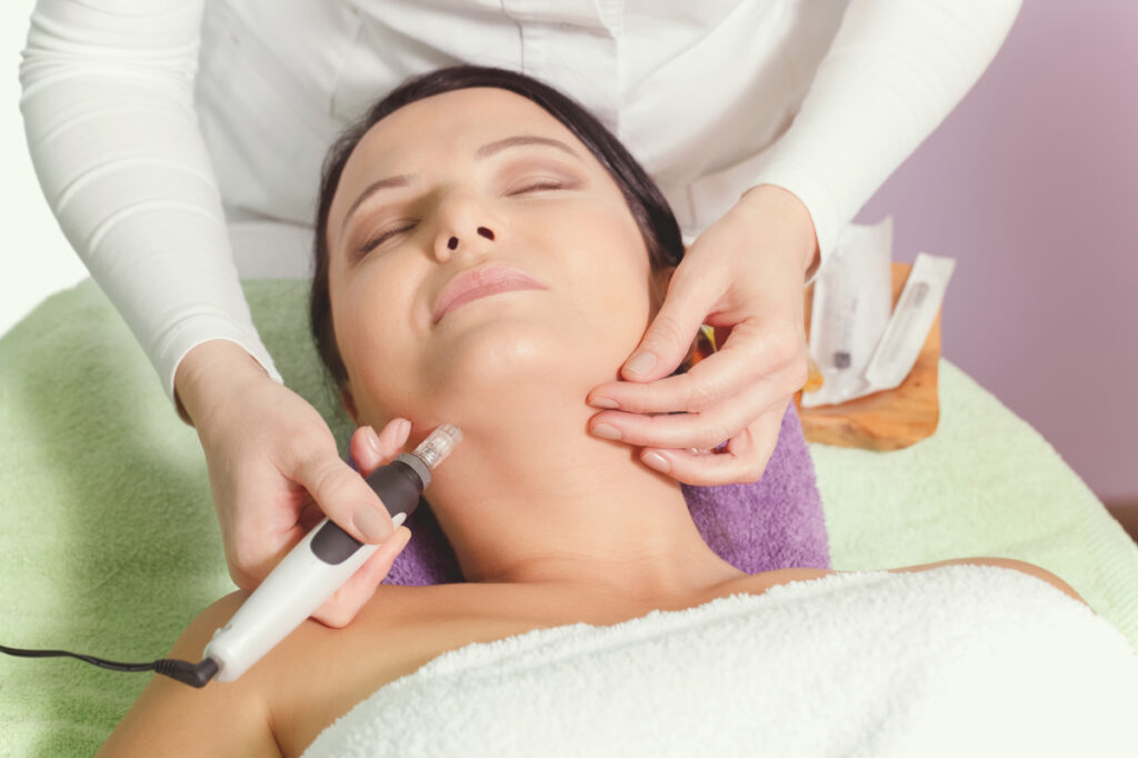 microdermabrasion