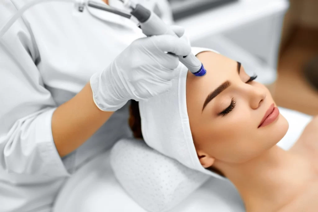microneedling